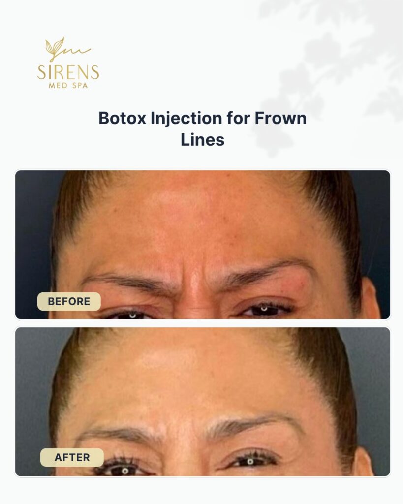 Sirens MedSpa - carousel8 (1)