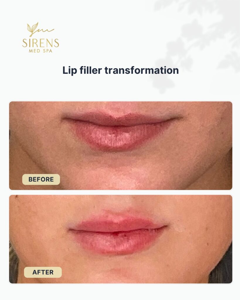 Sirens MedSpa - carousel8 (2)