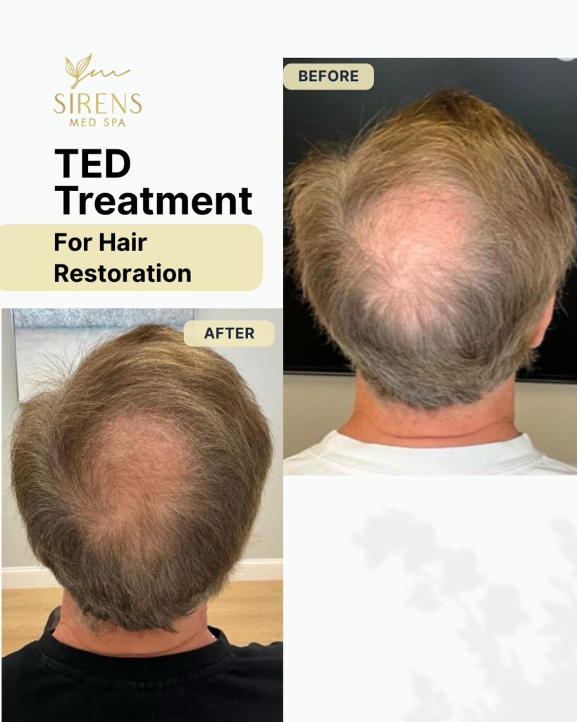 Sirens MedSpa - carousel8 (4)