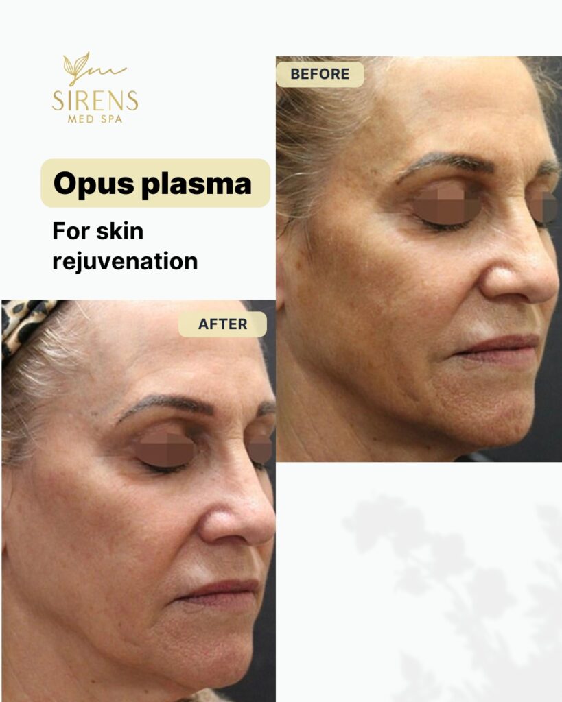 Sirens MedSpa - carousel8 (6)