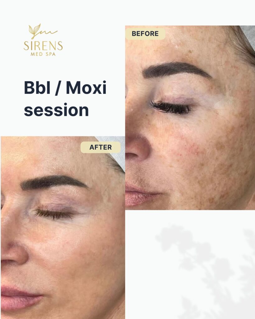 Sirens MedSpa - carousel8 (7)