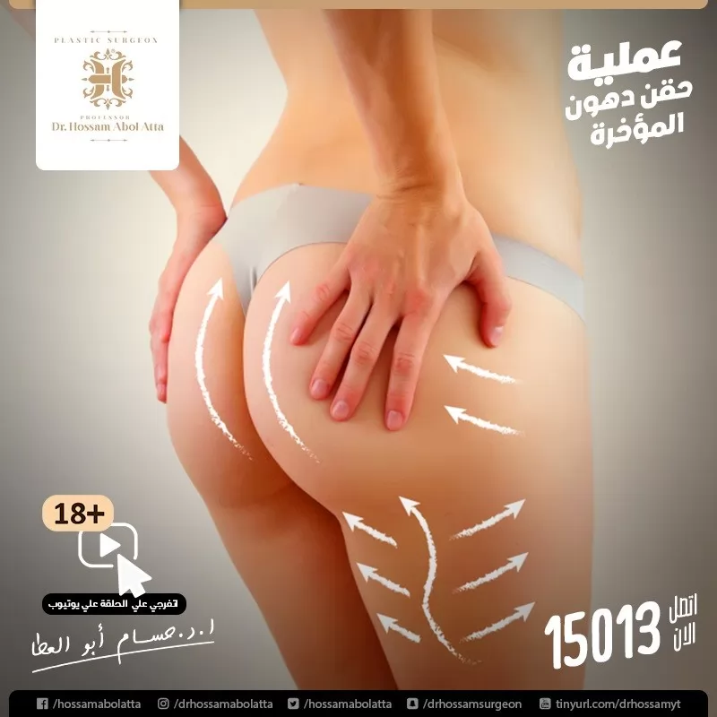 Hossam Abol Atta | Case Study