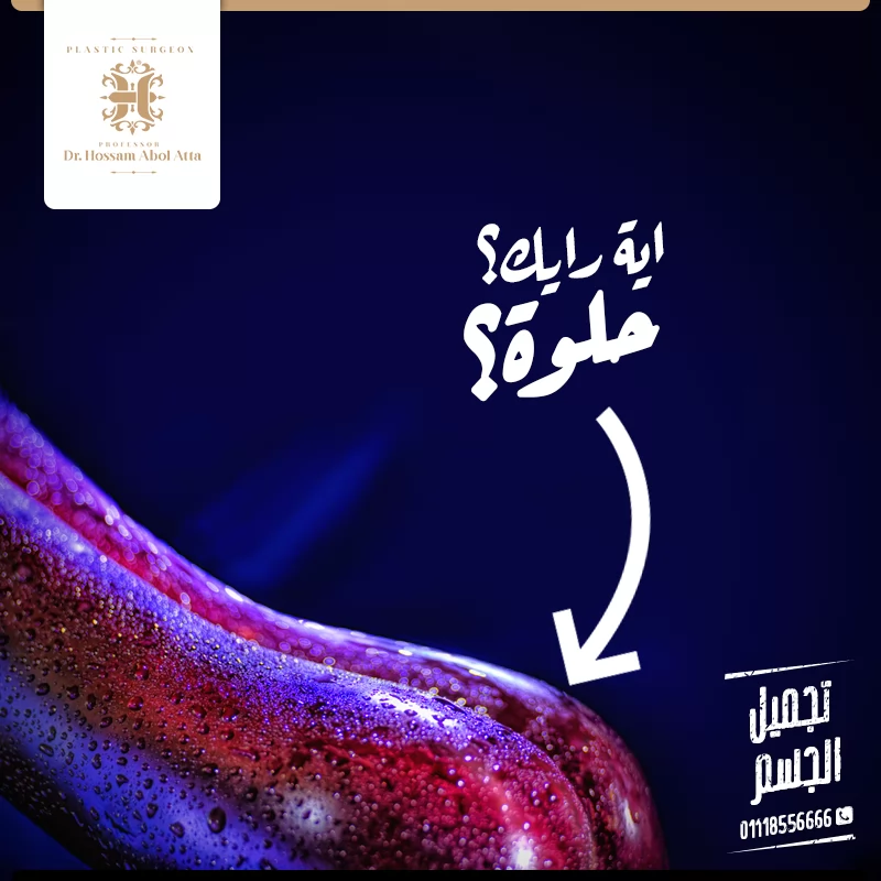 Hossam Abol Atta | Case Study