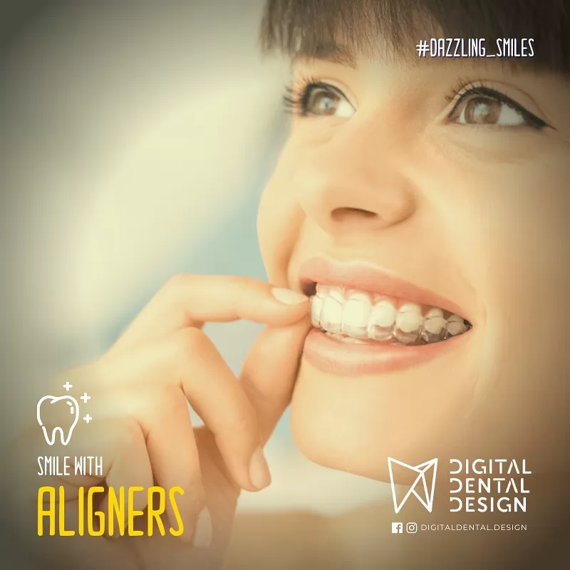 Digital Dental Design | Case Study