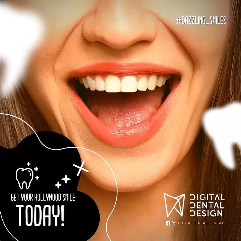 Digital Dental Design | Case Study