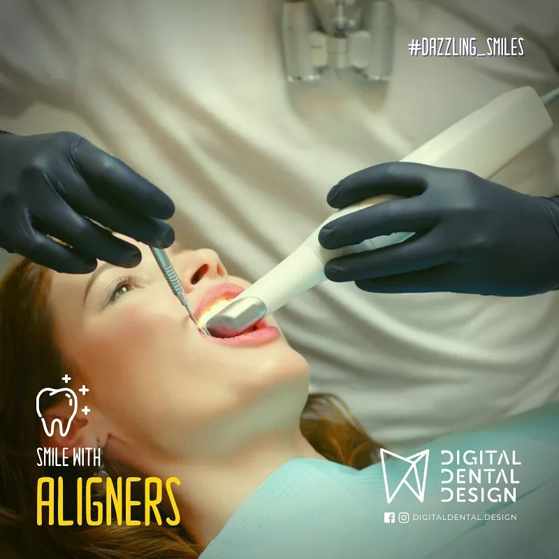 Digital Dental Design | Case Study