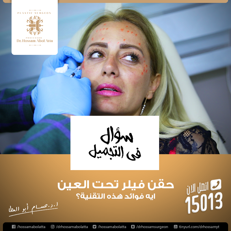Hossam Abol Atta | Case Study