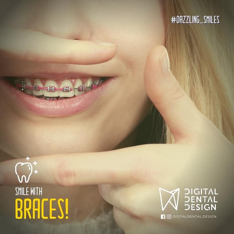 Digital Dental Design | Case Study