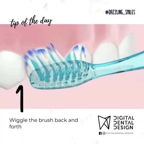 Digital Dental Design | Case Study