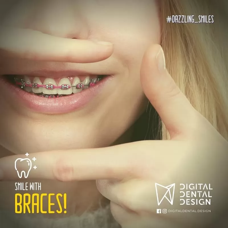 Digital Dental Design | Case Study